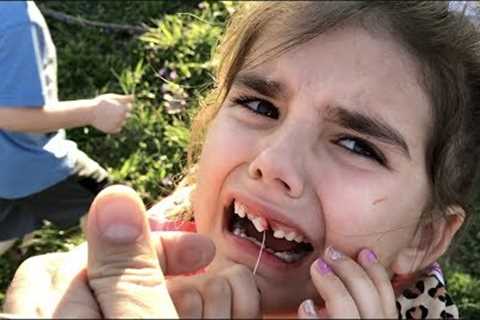 FAIL! Kids Pull Loose Tooth With Rocket!